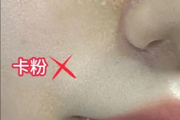 以油养肤-春日大干皮自救