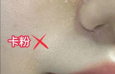 以油养肤-春日大干皮自救